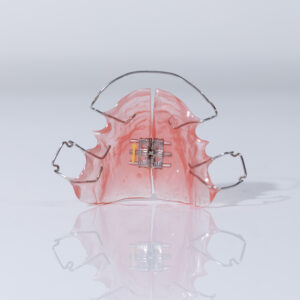 Rapid Palatal Expander