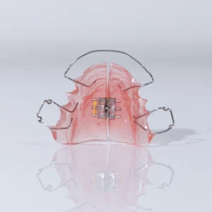 Rapid Palatal Expander