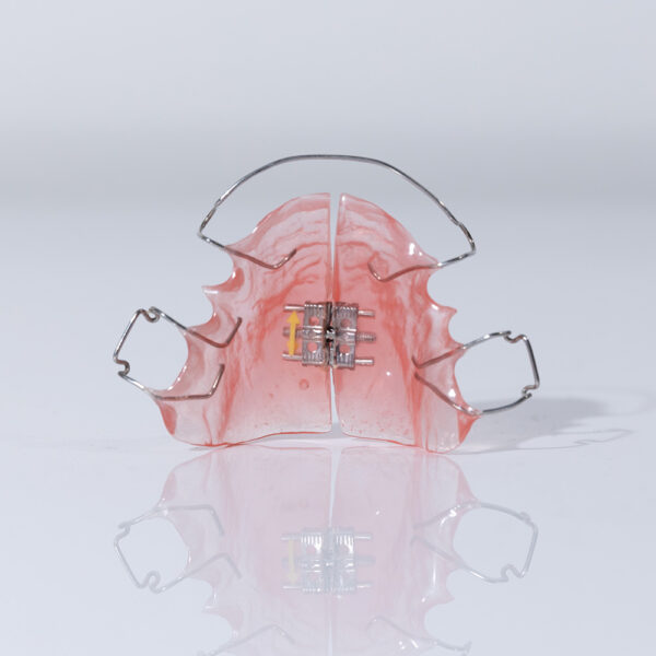 Rapid Palatal Expander