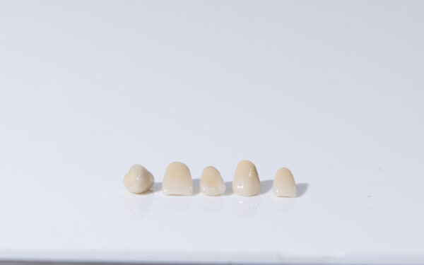 Zirconia Crown